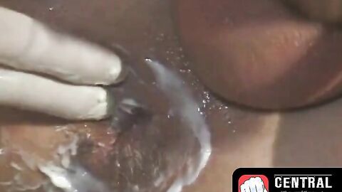 CentralFisting.com - Lubed-up homo's ass gaped and fisted in a wild threesome
