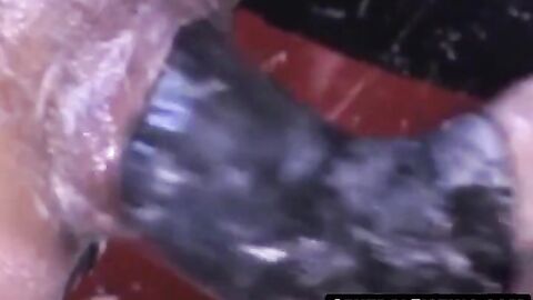 CentralFisting.com - Heyford's anal prolapse from double fisting