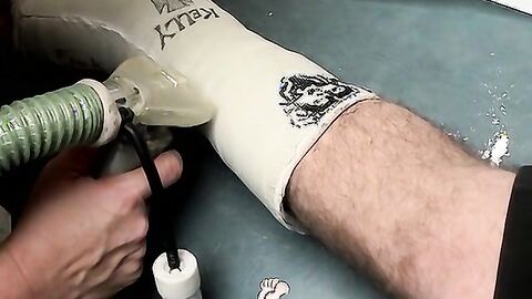 Foot cast placed on twink and his leg before being taken off