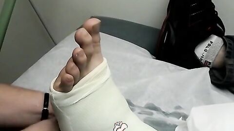 Foot cast placed on twink and his leg before being taken off