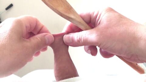 Nut And Foreskin - three Of six - Spoon