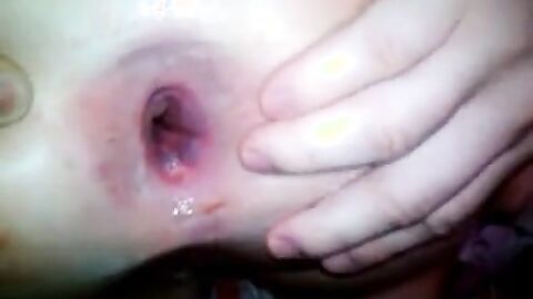 Emo Twinks Bareback Amateur Video